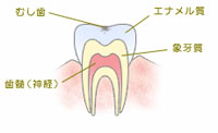 C0：脱灰